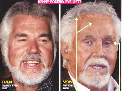 Kenny Rogers Plastic Surgery Images