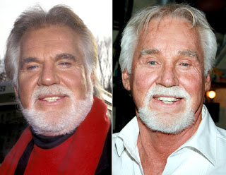 Kenny Rogers Plastic Surgery Photos
