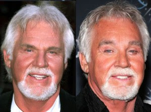 Kenny Rogers Plastic Surgery Photos