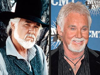 Kenny Rogers Plastic Surgery Pictures Before After