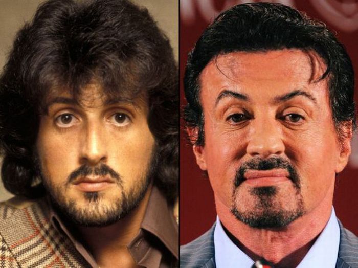Kenny Rogers Plastic Surgery Pictures Before After