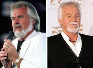 Kenny Rogers Plastic Surgery Pictures Before After