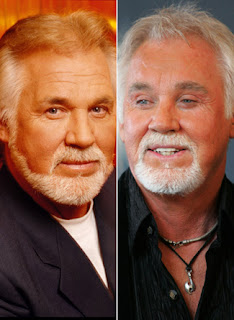 Kenny Rogers Plastic Surgery Pictures Before After